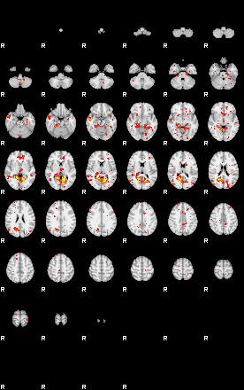 Patient:25;component:161