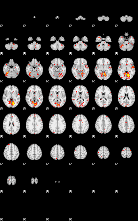 Patient:25;component:181