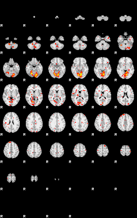 Patient:25;component:191