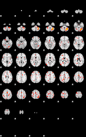 Patient:25;component:199