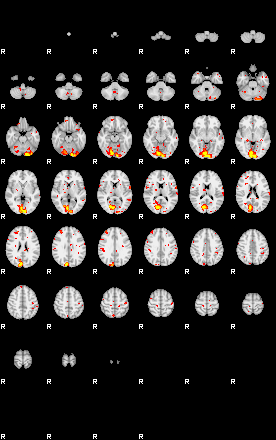 Patient:25;component:30