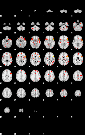 Patient:25;component:41