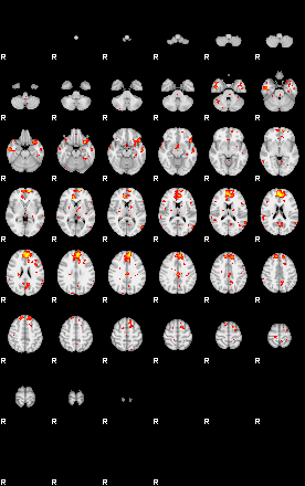 Patient:25;component:44