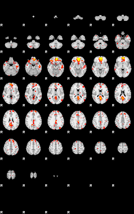 Patient:25;component:49