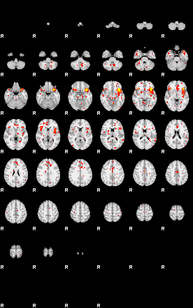 Patient:25;component:52