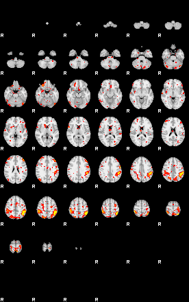 Patient:25;component:60