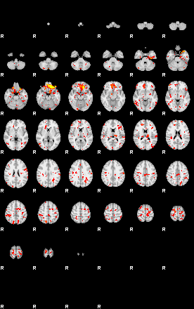 Patient:26;component:113