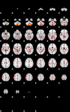 Patient:26;component:115