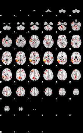 Patient:26;component:131