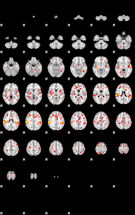 Patient:26;component:150