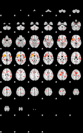 Patient:26;component:151