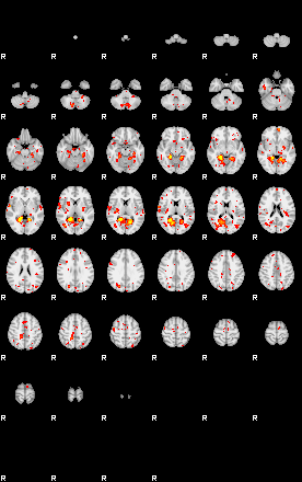 Patient:26;component:161