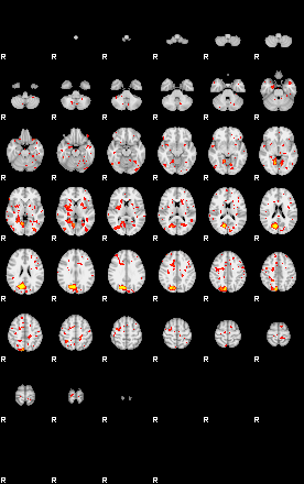 Patient:26;component:182