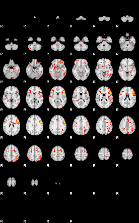 Patient:26;component:94