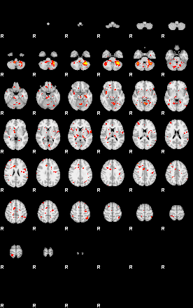 Patient:27;component:135