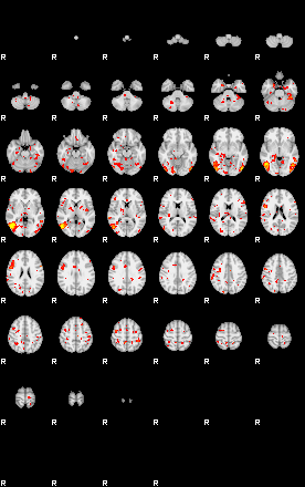 Patient:27;component:143