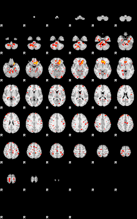 Patient:27;component:144