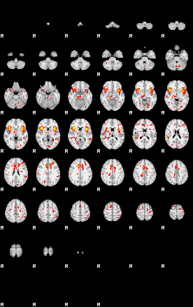 Patient:27;component:151