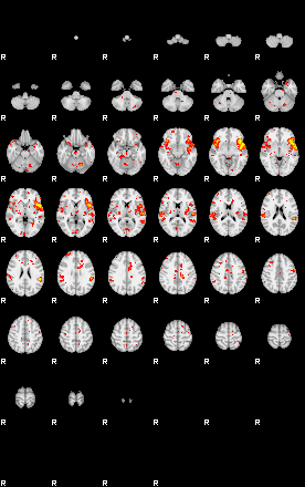 Patient:27;component:195