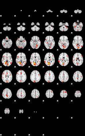 Patient:27;component:29