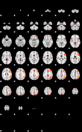 Patient:27;component:48