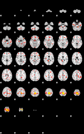 Patient:27;component:55