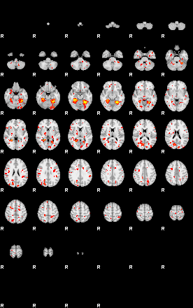 Patient:27;component:69