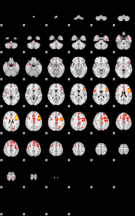 Patient:28;component:109