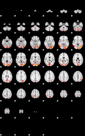 Patient:28;component:111