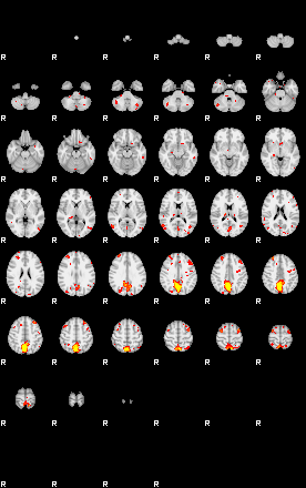 Patient:28;component:118