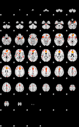 Patient:28;component:125