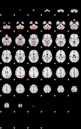 Patient:28;component:130