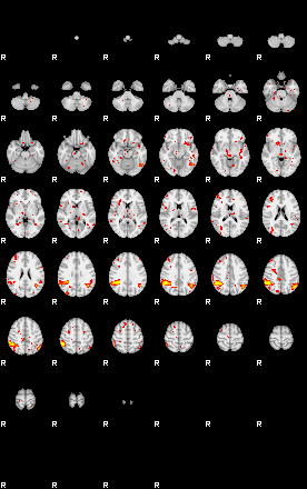 Patient:28;component:138