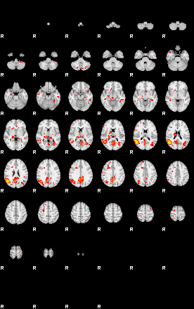 Patient:28;component:142