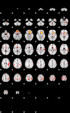 Patient:28;component:144