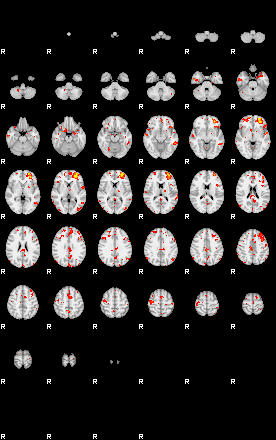 Patient:28;component:149