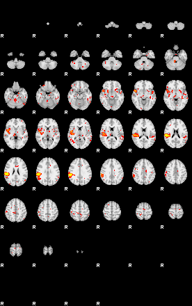 Patient:28;component:150