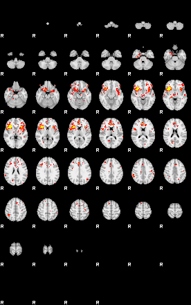 Patient:28;component:151