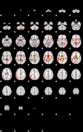 Patient:28;component:174