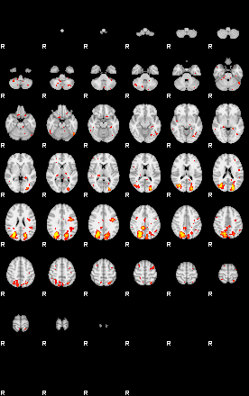 Patient:28;component:182