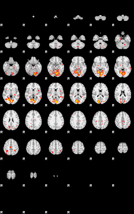 Patient:28;component:191