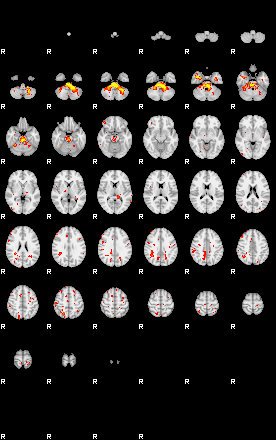 Patient:28;component:32