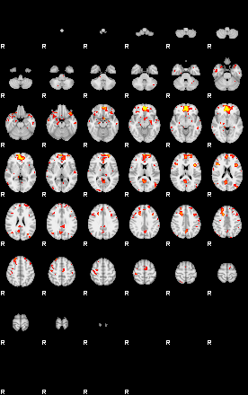 Patient:28;component:49