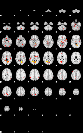 Patient:28;component:5