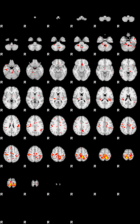 Patient:28;component:55