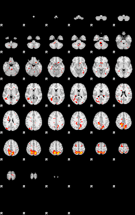 Patient:28;component:91