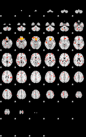 Patient:29;component:113