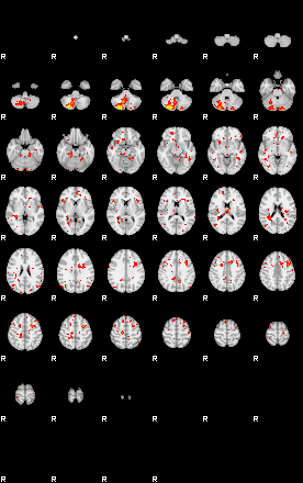 Patient:29;component:114