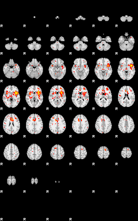 Patient:29;component:125