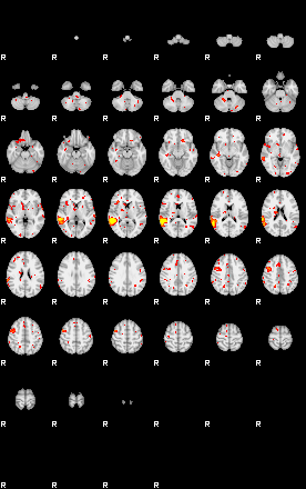 Patient:29;component:131